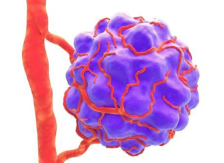 Tumor Therapy