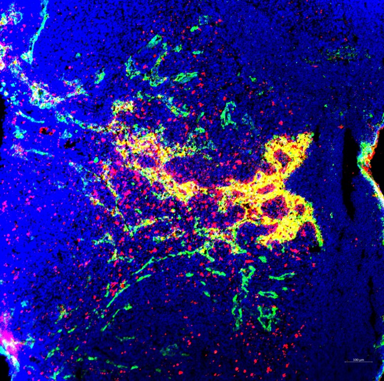 Tumor Cell Nanovaccines Based on Genetically Engineered Antibody‐Anchored Membrane.