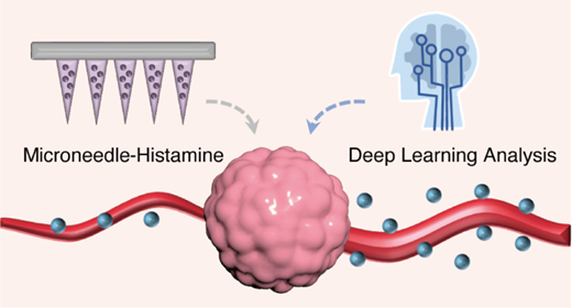 Redefining Tumor Vascular Permeability through Deep Learning-Guided Microneedle Delivery